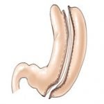 Le Centre Namurois de l&rsquo;Obésité